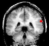 (a) Activations in the TPJ, IFG, ACC, and anterior insula showed a significantly