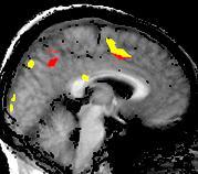 (a) Distinct context-dependent (lack arrows) and context-independent (white arrows) suregions >150 mm 3