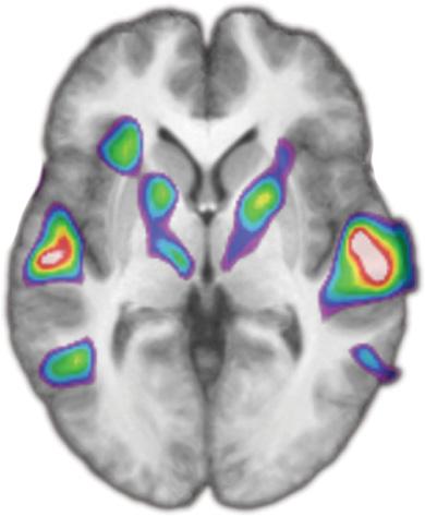 7852 J. Neurosci., May 25, 2011 31(21):7848 7856 Kim and Zatorre Tactile Auditory Shape Learning Figure 4.