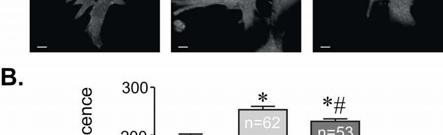Representative confocal images showing DAF-loaded untreated control (left panel), treated with Ang-