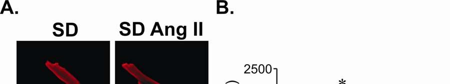 Supplemental Figures Supplemental Figure 1: Ang II induced
