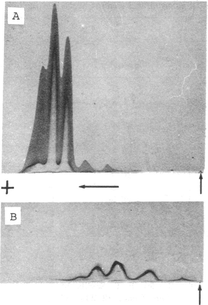 Medical Sciences: Yoshida et al. Proc. Nat. Acad. Sci. USA 73 (1976) 1327 A j C + - +... t B D.4.. FG. 3. mmunoprecipitation patterns after crossed antigen-antibody electrophoresis.