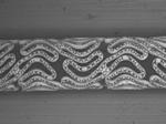 Properties of the JACTAX Stent Unexpanded Expanded JA Coating 9.2 g. of Paclitaxel and 9.