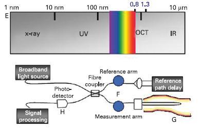 Optical Coherence Tomography (OCT) is an imaging modality able to provide high-resolution images of vessels in vivo While