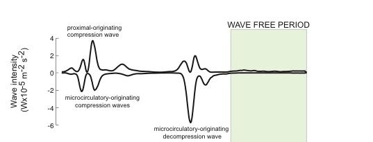 Instant Wave-Free Ratio (ifr): Naturally occurring