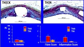 The Value of Thin Stent Struts PreClinical Models have demonstrated Reduced acute injury
