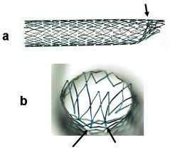 Balloon-expandable stents (more