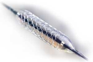 Scaffold function Endoluminal Stents Compresses acute post-angioplasty intimal/medial flaps Buttresses