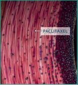 ) Drug: Paclitaxel Excipient: Urea Urea hydrates upon contact with blood & drug released Paclitaxel binds to the vessel wall Paclitaxel penetrates into media & adventitia Can remain