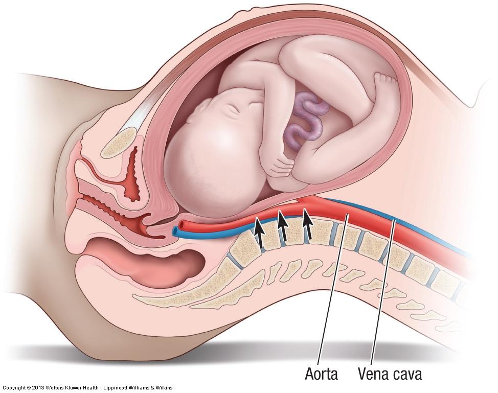 Other Reproductive System Conditions" Pregnancy The state of carrying a fetus.