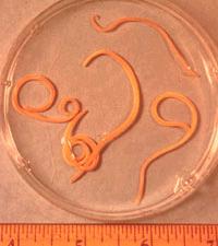 Nematoda- Roundworms Some free-living and some parasites Cylindrical bodies Efficient one-way Digestive system a tube that opens at both ends Food enters through