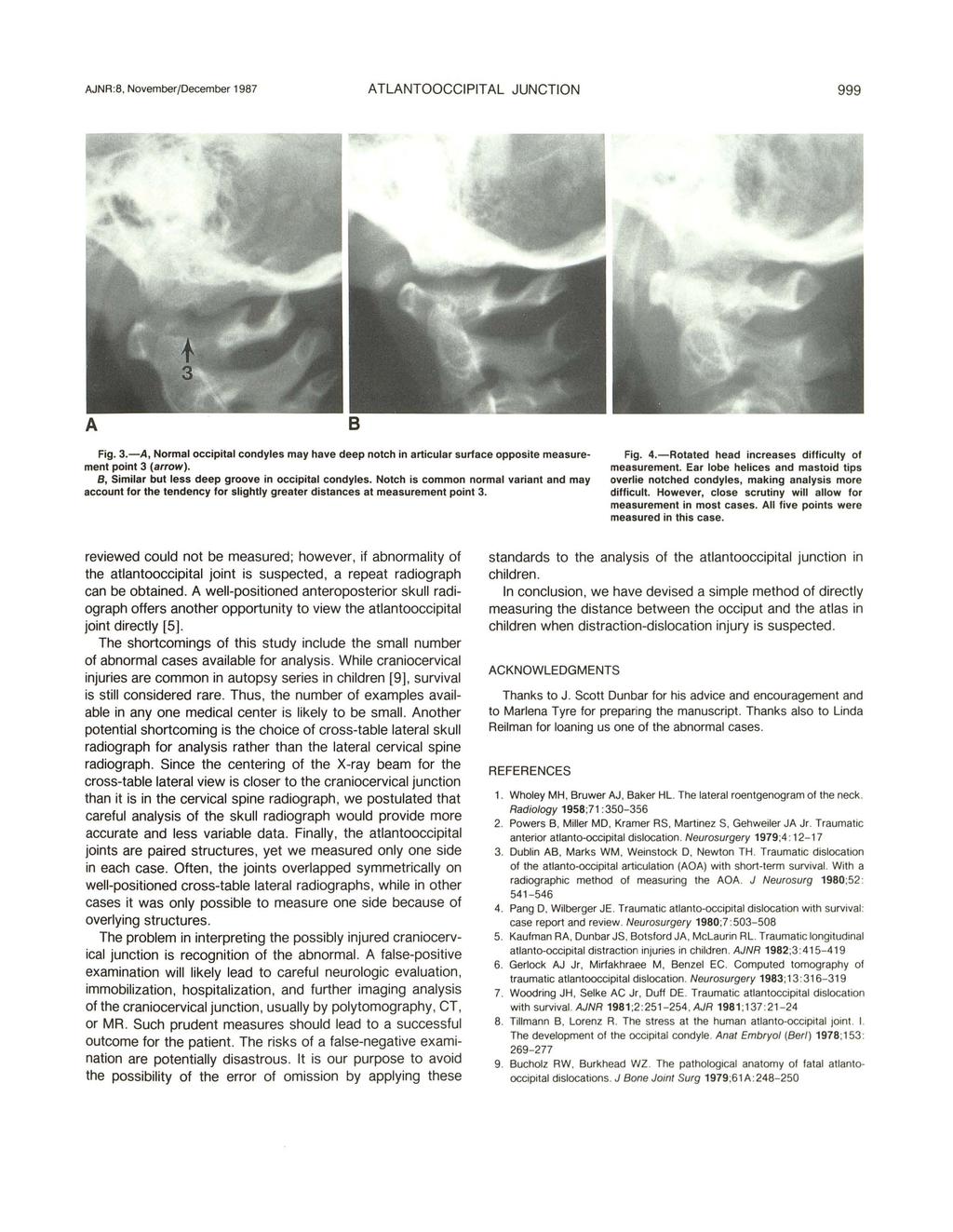 AJNR :8. November/December 1987 ATLANTOOCCIPITAL JUNCTION 999 Fig. 3.-A, Normal occipital condyles may have deep notch in articular surface opposite measurement point 3 (arrow).