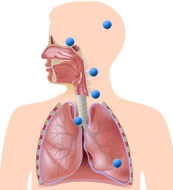 Terminology Each dot indicates a different type of infection of the upper or lower respiratory