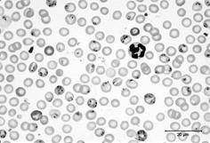 Malaria parasites in mammalian red blood cells 4 What selective factors act on parasite virulence?