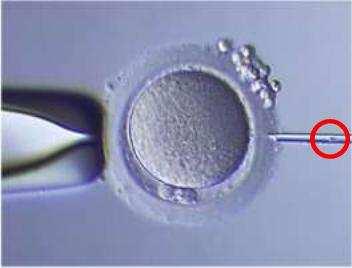 cells surrounding it must be removed, and the sperm prepared so that individual sperm can be recovered for injecting into each egg.