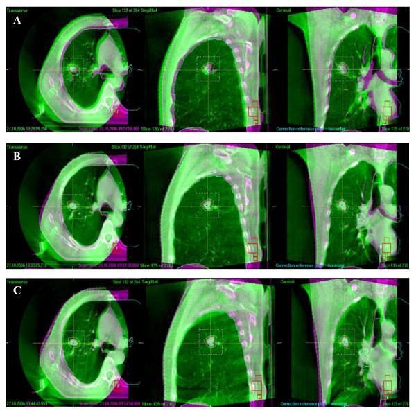 Imaging technology = IGRT of the last decade IGRT or image guided radiotherapy By taking images just before the