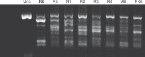 Figure 1 Characterization of Leishmania isolates by amplification of parasite kdna using AJS3/ DBY primers Unc = undigested.