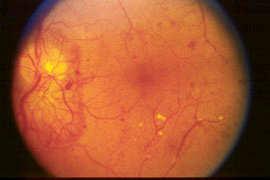 Red Eyes, Red Spots, and Red Flags Essential Knowledge of Eye Disease Andrew F.