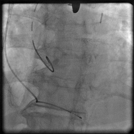 Aortic angiography