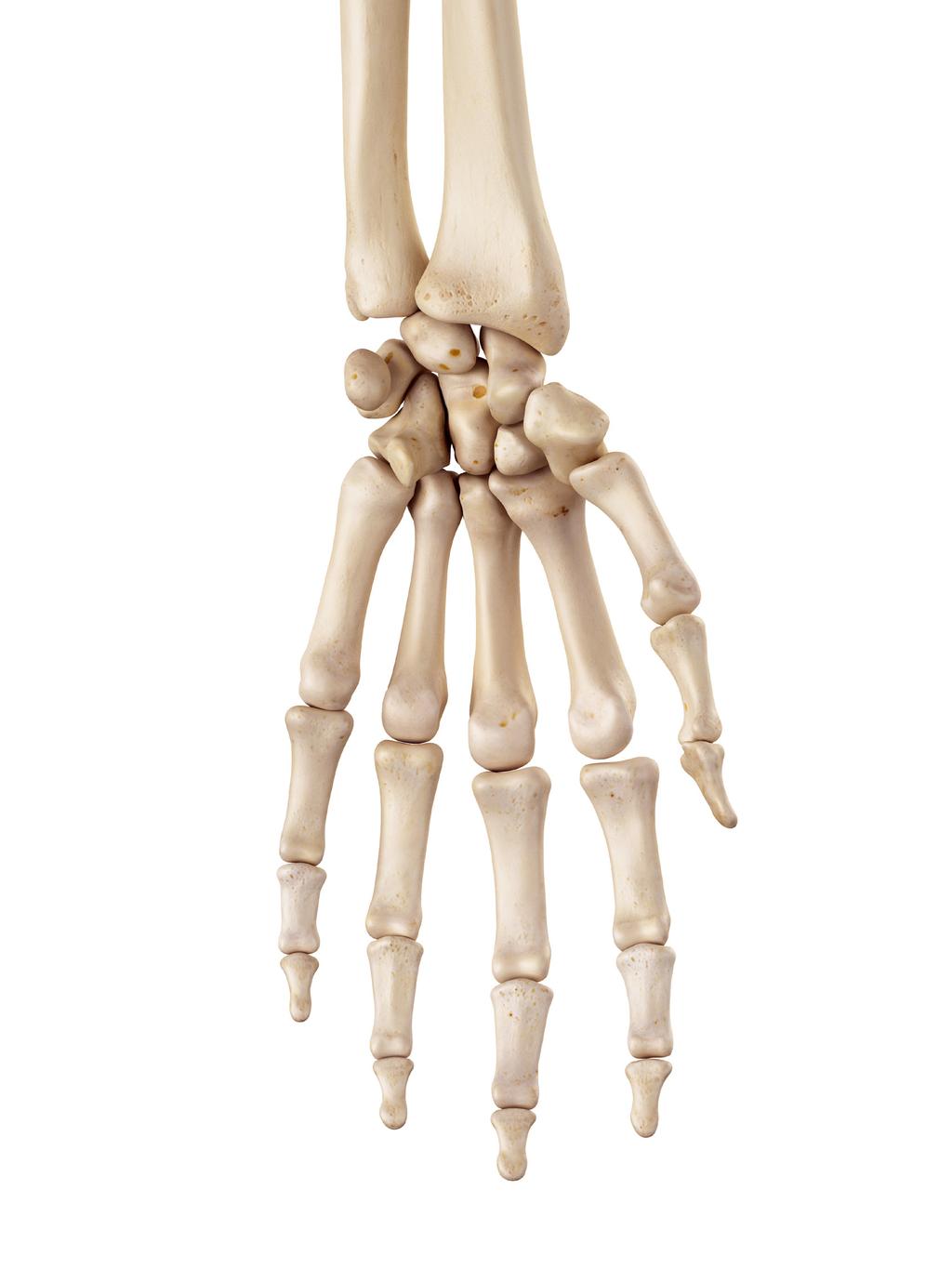 Hand and Wrist Solutions Arthroplasty