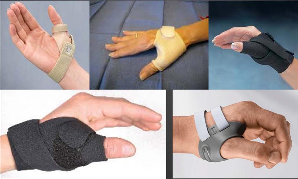 Splints When to refer to a hand surgeon?
