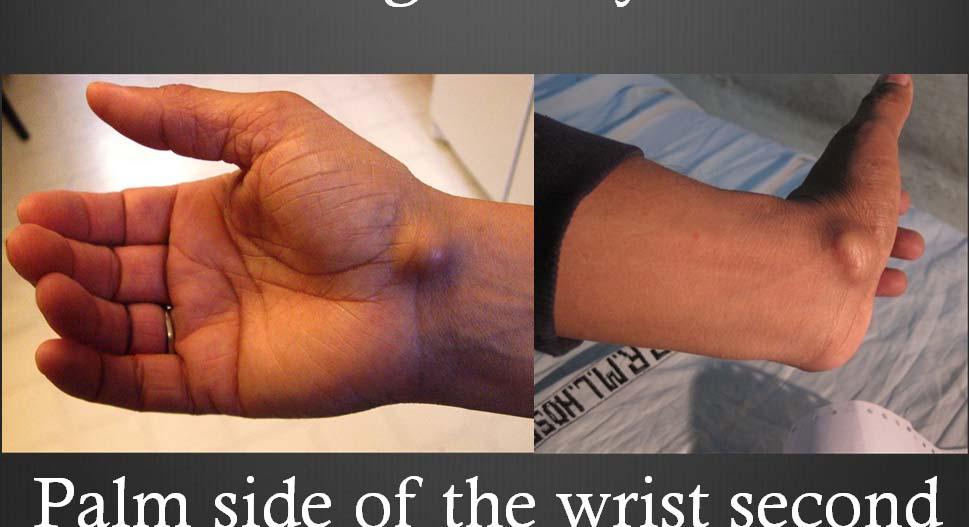 side of the wrist