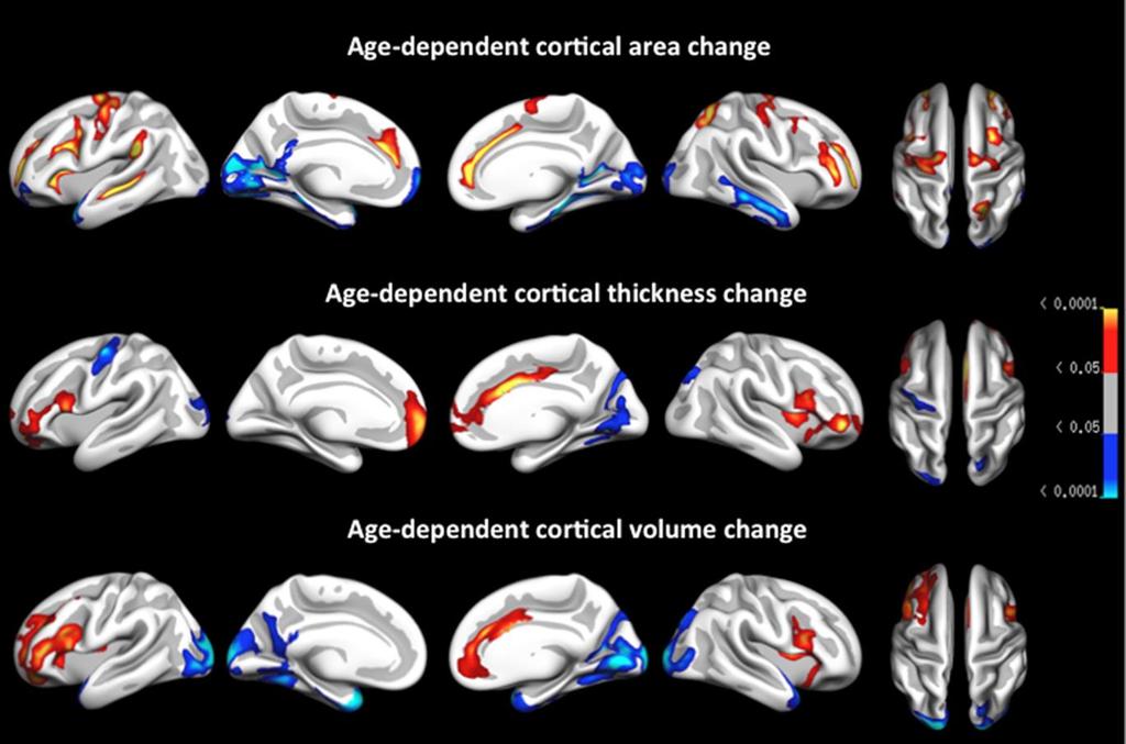Longitudinal cortical decline with