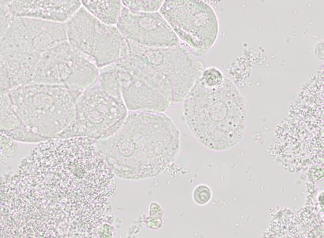 and Leukocytes. Bacteria are common in urine specimens.