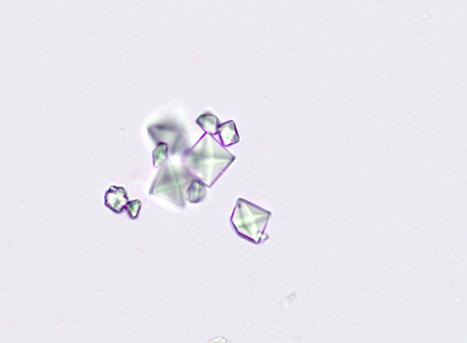 Application Note Figure 12 Calcium oxalate in urine. Crystalluria indicates that the urine is supersaturated with the compounds that comprise the crystals, e.g. ammonium, magnesium and phosphate for struvite.