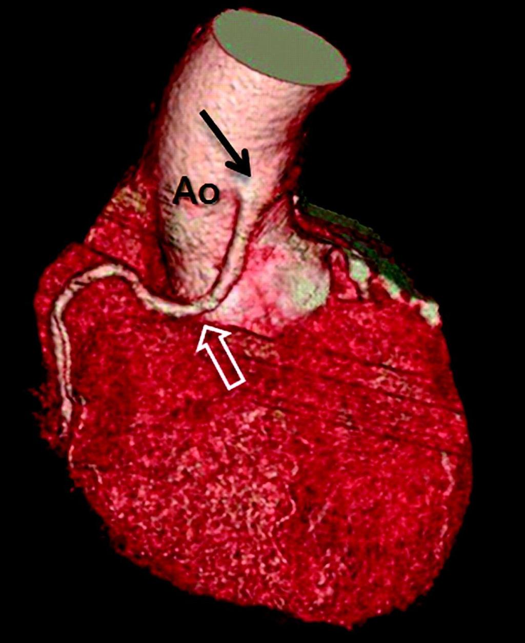 al. Heart