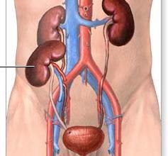 Steps involved in Kidney Transplant 1 st stage is to