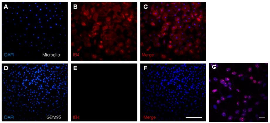 Figure: Culture of GBM95 cells is negative for IB4, but stains for Ki67. Cultured GBM95 cells were stained for IB4 (D, E, F) and Ki67 (G).