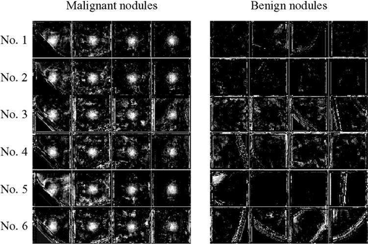 1142 IEEE TRANSACTIONS ON MEDICAL IMAGING, VOL. 24, NO. 9, SEPTEMBER 2005 Fig. 5.