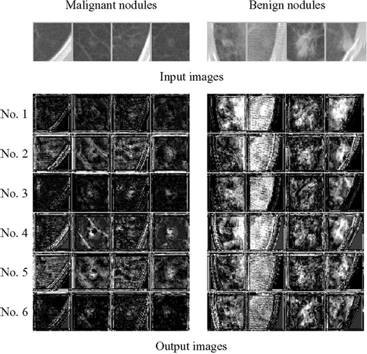 1144 IEEE TRANSACTIONS ON MEDICAL IMAGING, VOL. 24, NO. 9, SEPTEMBER 2005 Fig. 12.