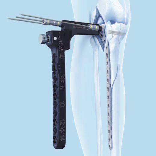 Surgical Technique 7 Secure aiming arm to handle and plate Instruments 03.120.001 Aiming Arm, for LCP Proximal Tibial Plate 4.5/5.0, right 03.120.004 Aiming Arm, for LCP Proximal Tibial Plate 4.5/5.0, left 03.