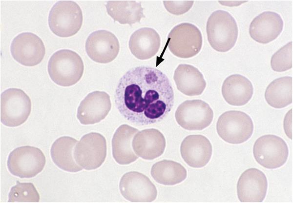 Diagnostic Techniques for Ehrlichia Peripheral blood smear Variable sensitivity, 2-38% Serology (IFA) retrospective Dx Paired sera required 4-fold rise in titer to 1:80 Name