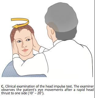 Vestibulocular Reflex (VOR) VOR = Keeping eyes on the target when head is