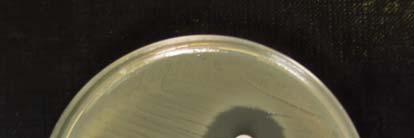 33 cefiksima ter cefuroksima. Plošče smo inkubirali 24 ur na 36 C. Primer antibiograma po inkubaciji za testirana antibiotika kaže slika 4.