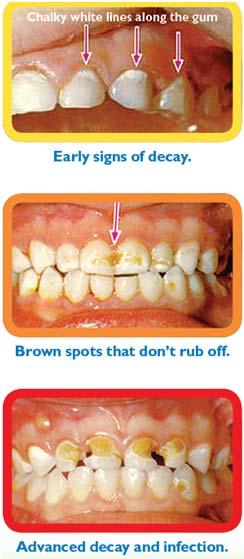 do, call your dentist for an appointment Image Source: Tasmania Department of Health and Human Services Adapted from the