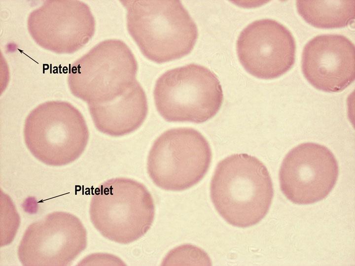 Platelets -