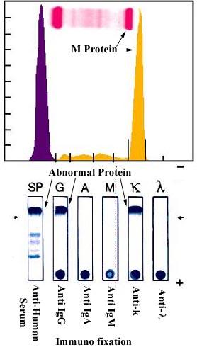 Serum protein