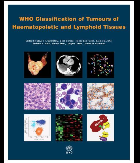 WHO Classification (4 th Edition - 2008): Chronic Myeloid Neoplasms