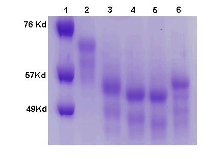 5 Results The simplest method of assessing the extent of deglycosylation is by mobility shifts on SDS-PAGE gels.