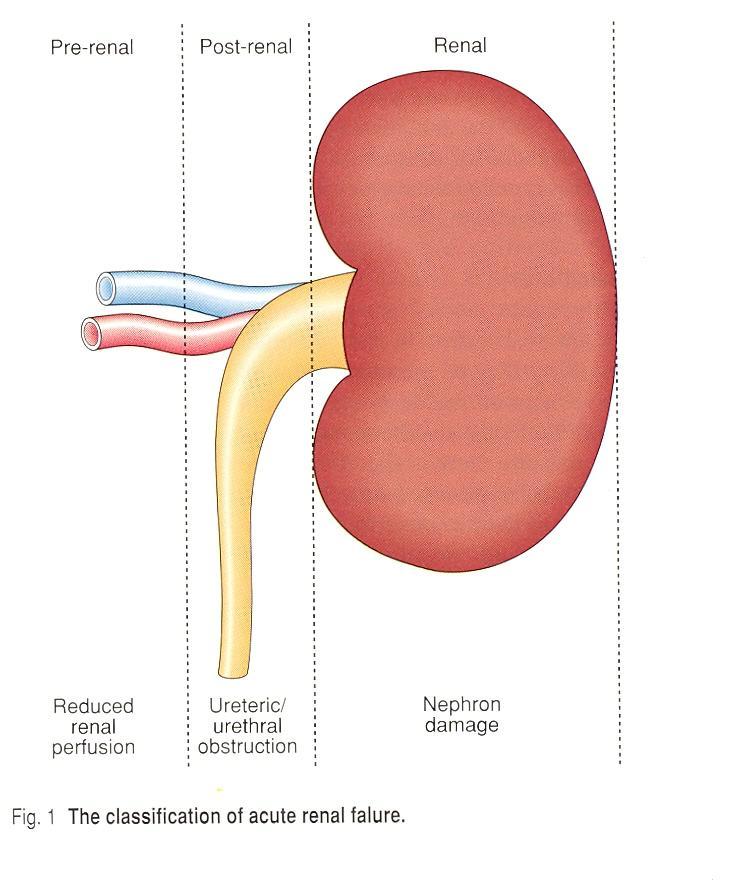 Classification of ARF: according to the location of the insult Prerenal Blood flow to kidneys Occurs in about 50-70% of all ARF cases Intrarenal