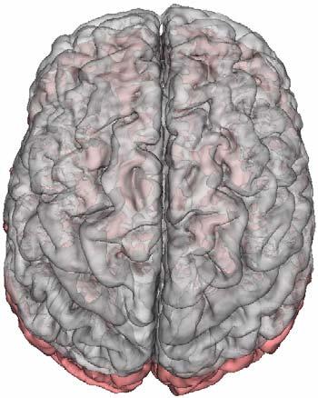 brain MRI s