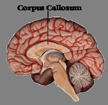 Corpus Callosum Autistic Brain Increasing agreement from structural