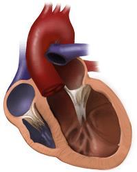 The Athlete s Heart - Overlap with