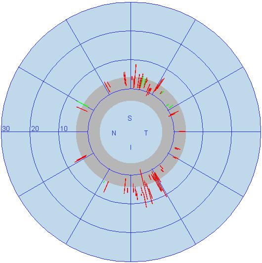 Polar Graph 60 The polar graph shows a red line with its length corresponding with the defect of each test location at the nerve fiber angle at the optic disc.