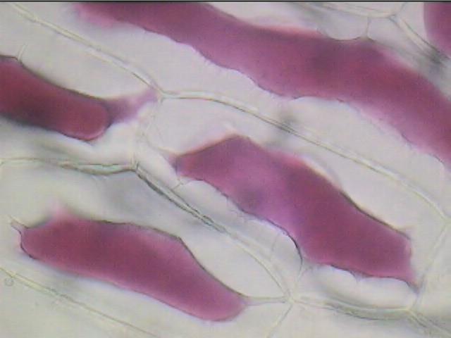 Red onion cells in SALT Solution (cell shrivels; water