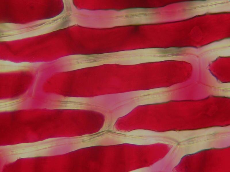 Red onion cells in Distilled Water (cell swells; water